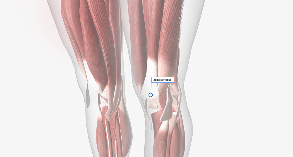 근감소증 자가진단