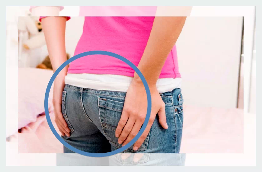 항문거근증후군