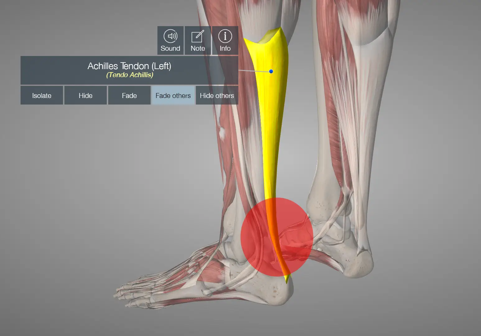 아킬레스건 파열 후 스포츠 복귀율과 재활 전략