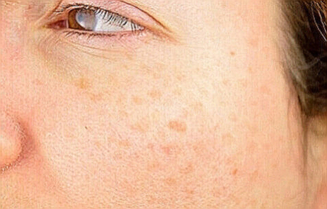 도미나크림 가격 부작용 사용법