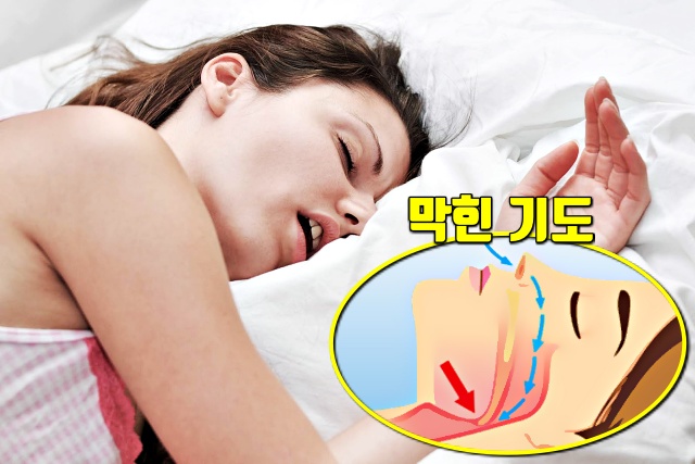 돌연사,코골이 줄이는방법,코골이방지베개,수면무호흡증 증세,건강,팁줌