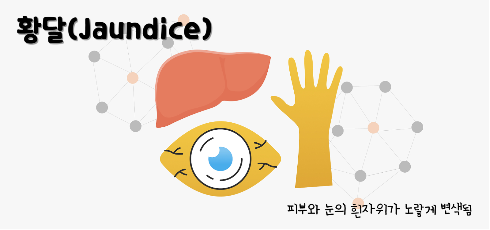 황달(Jaundice)
황달의 증상 : 피부와 눈의 흰자위가 노랗게 변색됨