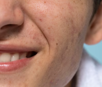 피부가려움증의 원인 5