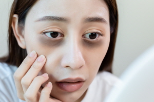 다크서클 없애는 방법