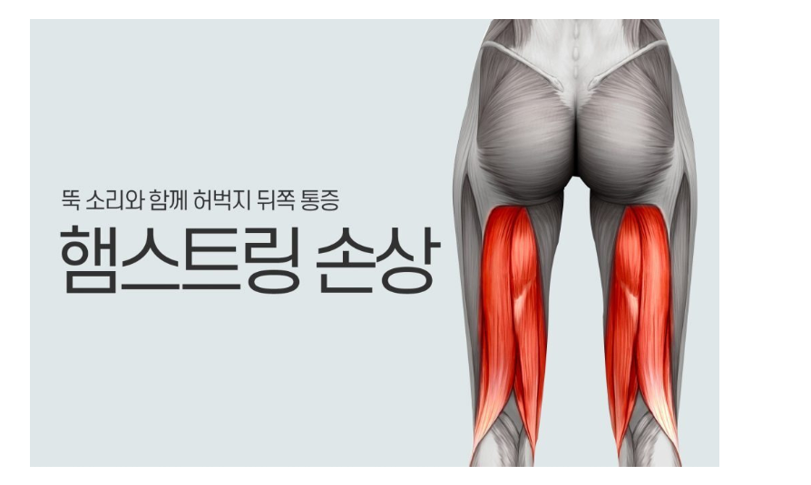 햄스트링 부상 예방을 위한 스트레칭 방법