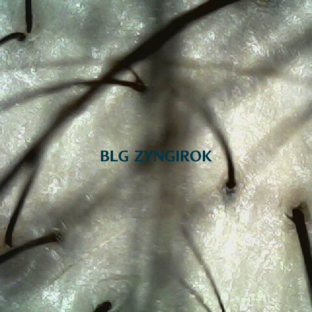 탈모 극복 프로젝트 - 정수리와 이마 사이 두피모습이다.