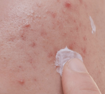 환절기&amp;#44; 수분 크림의 함정