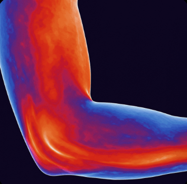 골프 엘보 증상과 관리법5