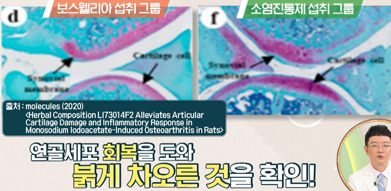 보스웰리아 효능