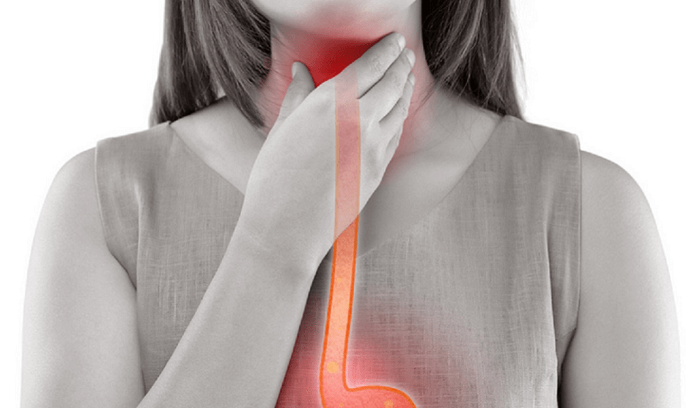 역류성 식도염 관리법