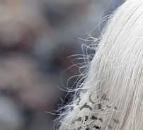 비문증 치료방법