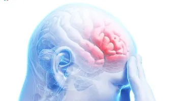 뇌진탕 초기 증상 후유증 으로_7