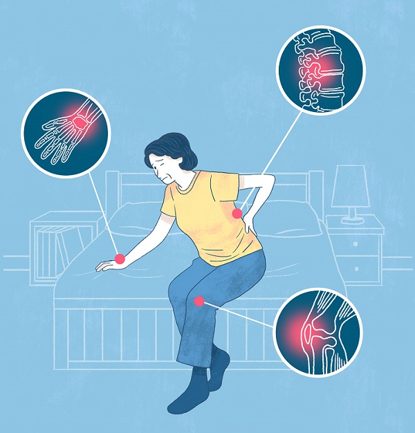 골다공증에 좋은 음식과 운동에 대해