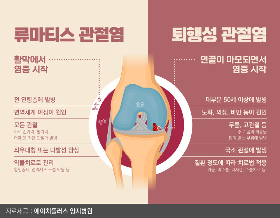 류마티스 관절염과 퇴행성 관절염 설명 사진