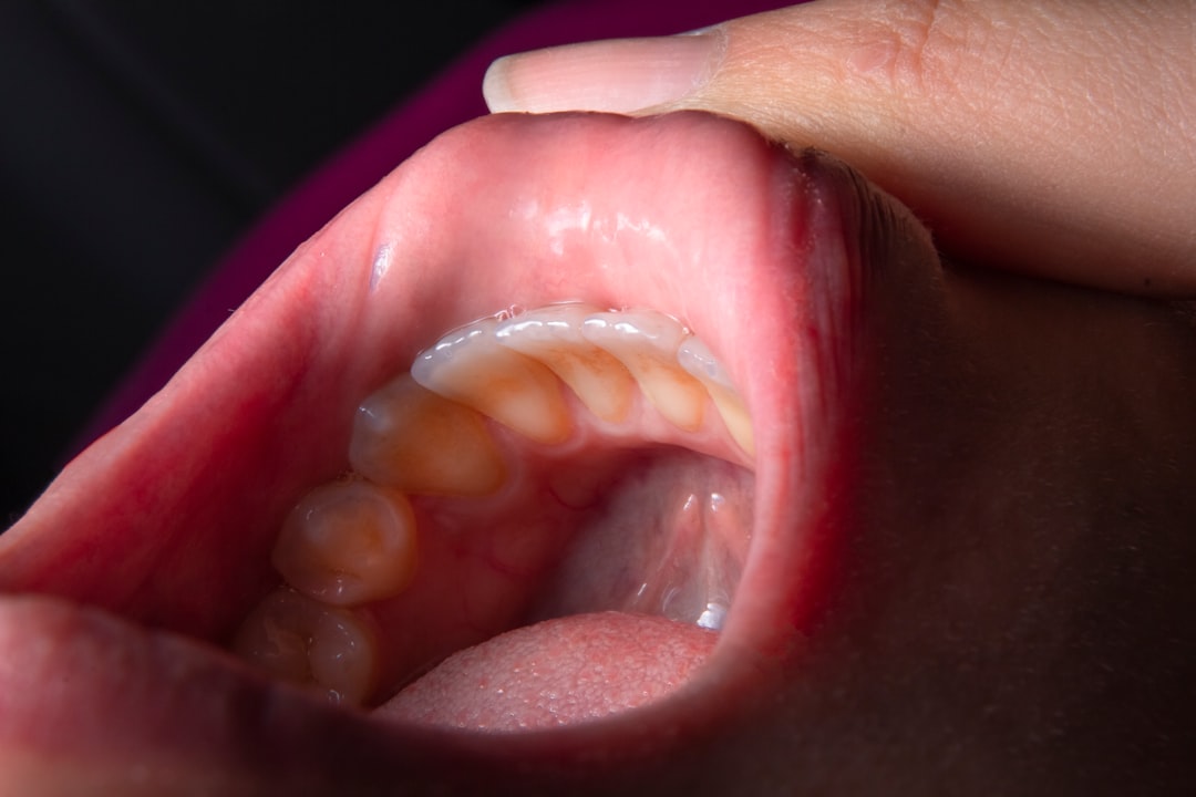 Throat