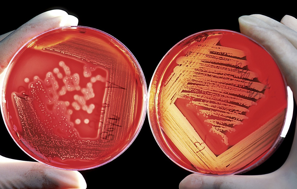 스트렙토코커스 뮤탄스 균의 특징과 예방및 치료방법