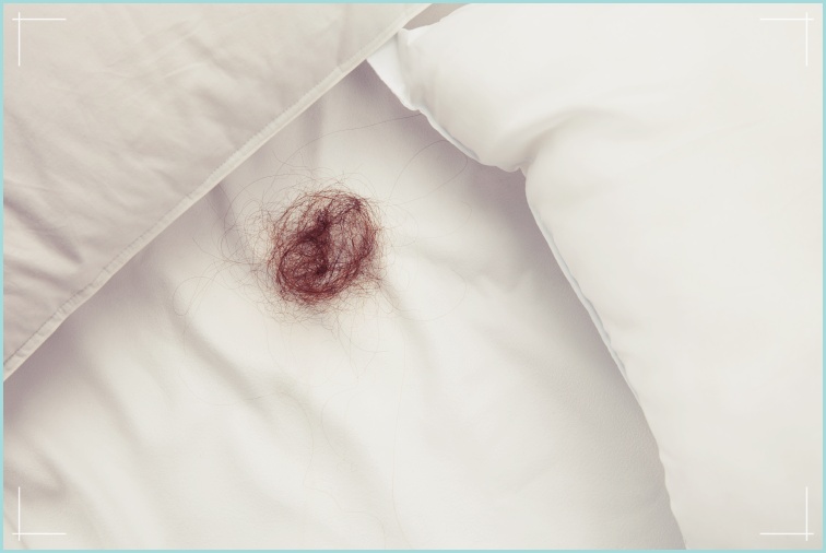 탈모 치료의 부작용을 대처하는 방법은