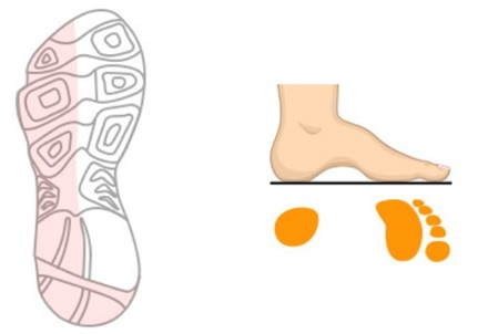 하이아치 런닝화 고르는법