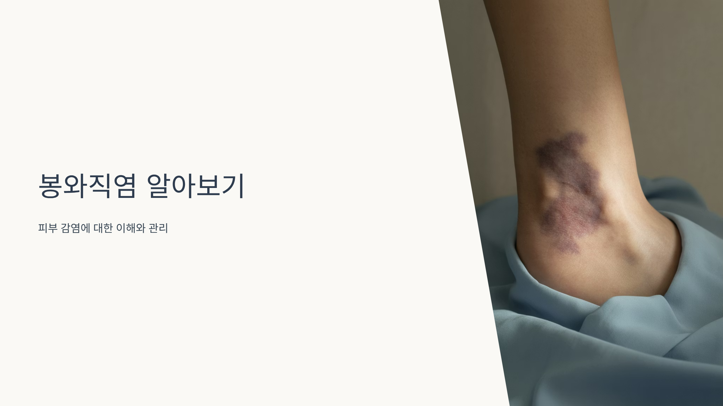 봉와직염 증상부터 치료까지 완벽정리