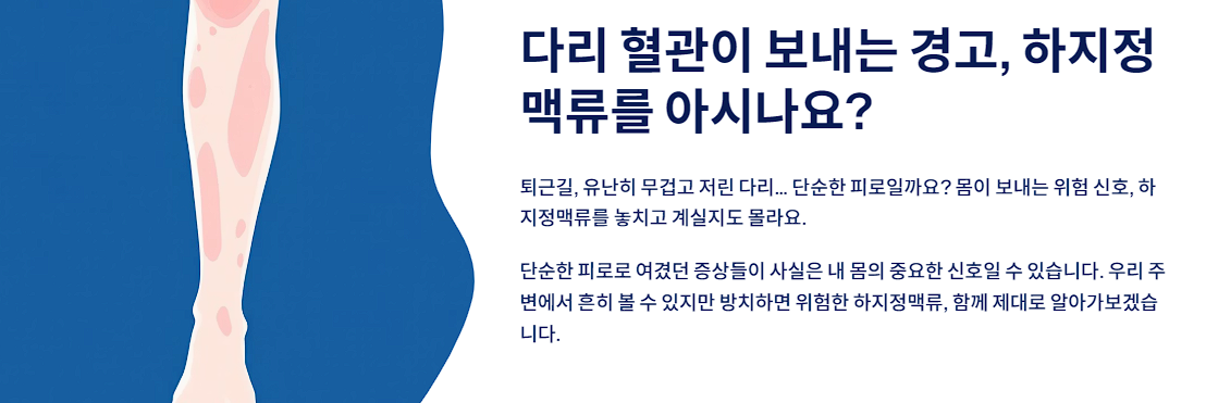 다리 혈관이 보내는 경고, 하지정맥류를 아시나요?