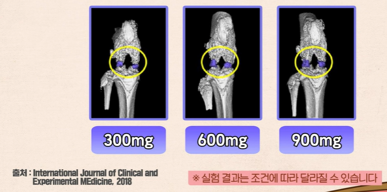콘드로이친 효능