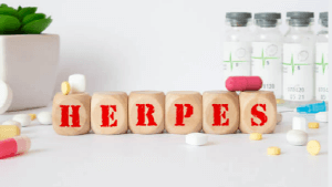 헤르페스