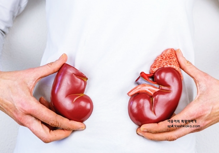 신장에 좋은 음식