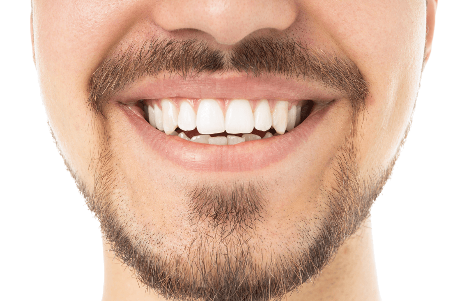 치아 착색과 세균막(바이오필름)은 같은 문제일까?