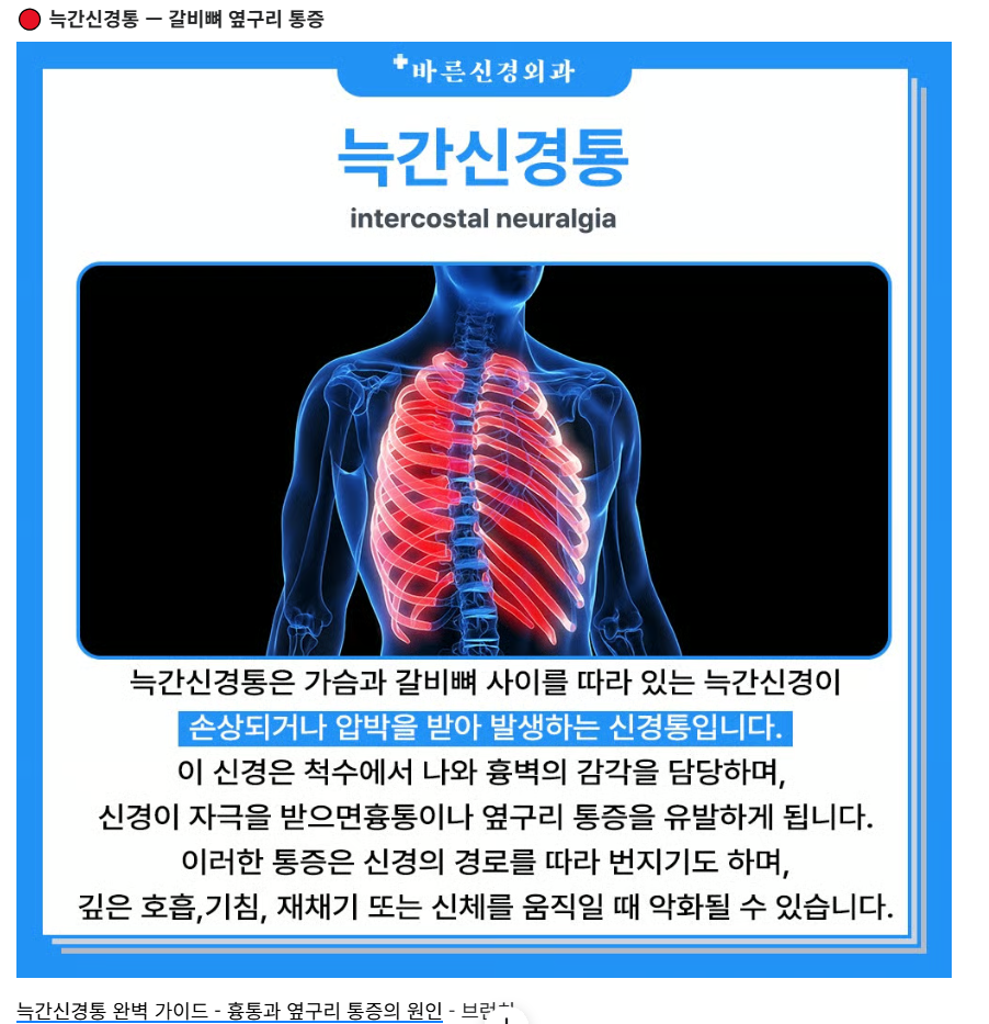 왼쪽 오른쪽 옆구리 통증 원인 5가지와 찌릿한 증상별 대처법 총정리