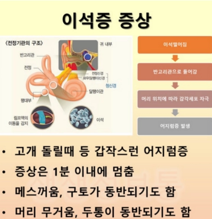 이석증-증상