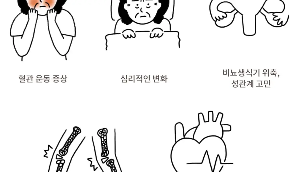 폐경 전조증상