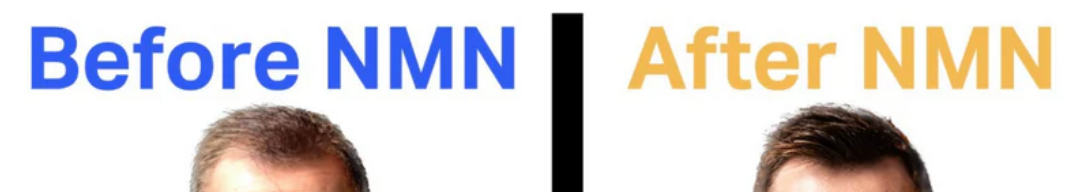 NMN 복용 전과 복용 후의 이미지 사진