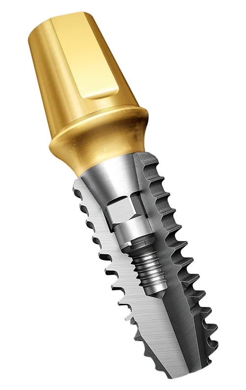 오스템 임플란트 수명 시술기간_3