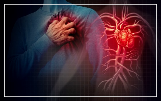 심근경색_전조증상