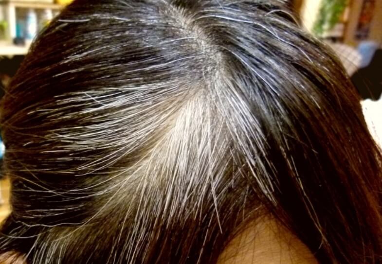 탈모 예방 혈자리