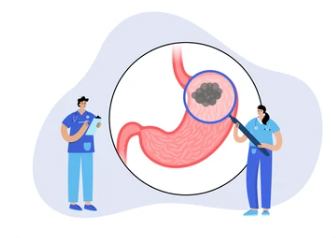 위암 환자 피해야할 음식
