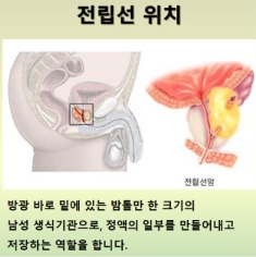 전립선비대증 치료와 좋은음식 총정리