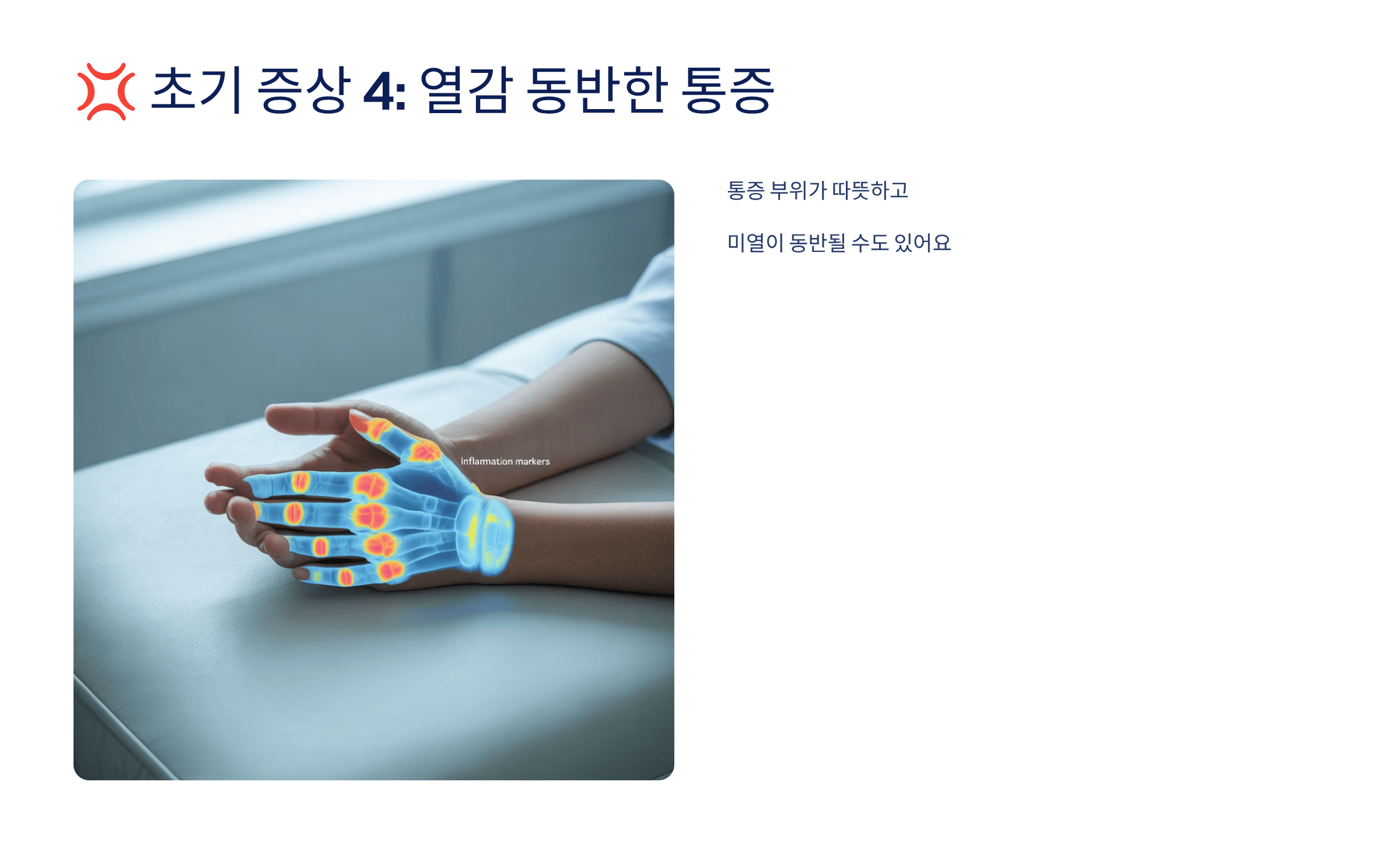 류마티스 관절염 초기증상 사진입니다.