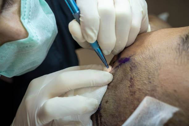 동공과다증 원인 및 치료, 9가지 예방 방법