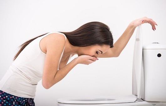 뇌동맥류 코일색전술