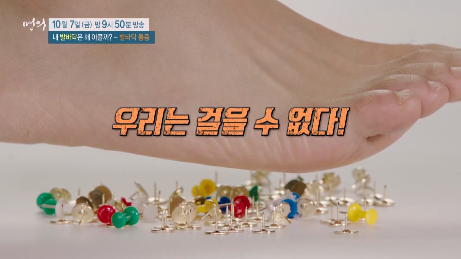 명의 족저근막염, 지간신경종, 무지외반증, 지방패드위축증후군 발바닥 통증 운동 치료