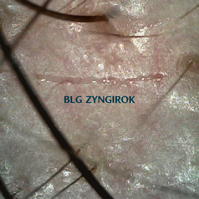 피나모아 복용 19주차 - 오른쪽 M자 부위 두피 모습이다.