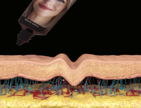 호주주름크림-미라클-시드니-크림