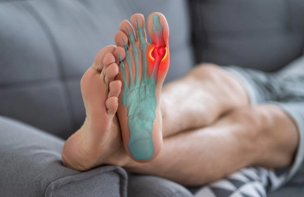 통풍 자주 묻는 질문 FAQ