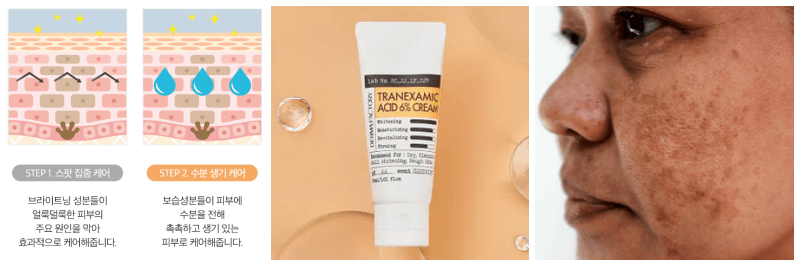 더마팩토리 트라넥삼산 크림, 기미 사진