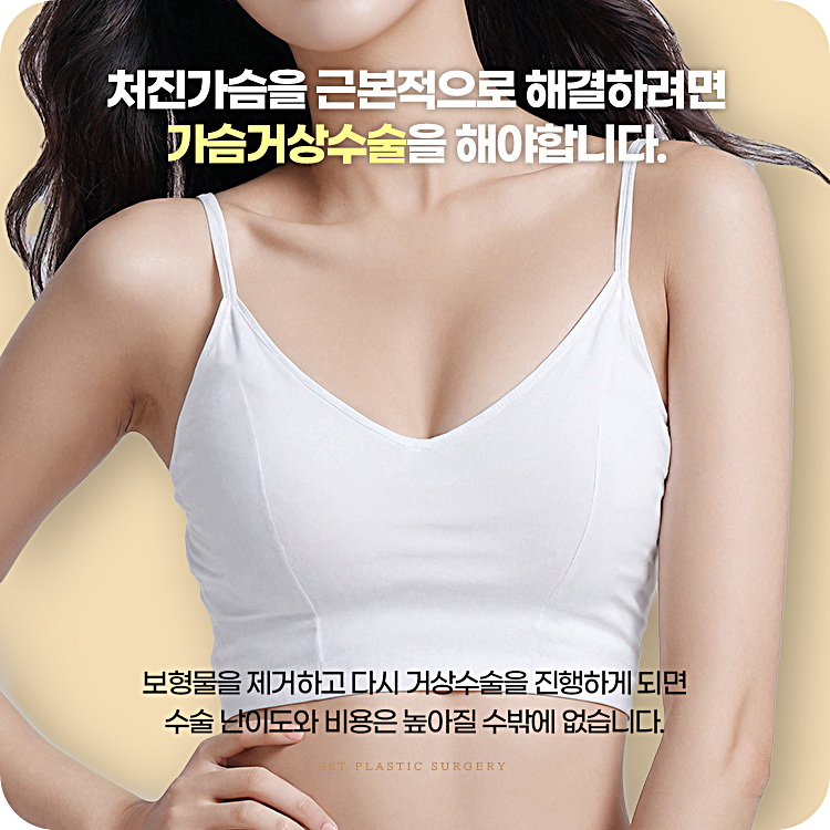 처진가슴을 근본적으로 해결하려면 가슴거상수술을 해야합니다. 보형물을 제거하고 다시 거상수술을 진행하게 되면 수술 난이도와 비용은 높아질 수밖에 없습니다.