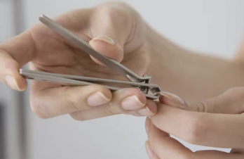 발톱 무좀 치료