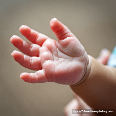 아기 손발 땀, 아기 손발 땀 언제까지, 아기 손발 땀 이유, 아기 손발 땀 원인, 아기 다한증, 아기 체온 조절, 아기 손발 땀 대처