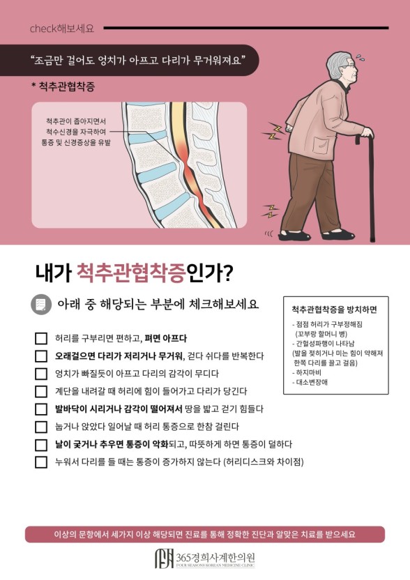 척추관 협착증