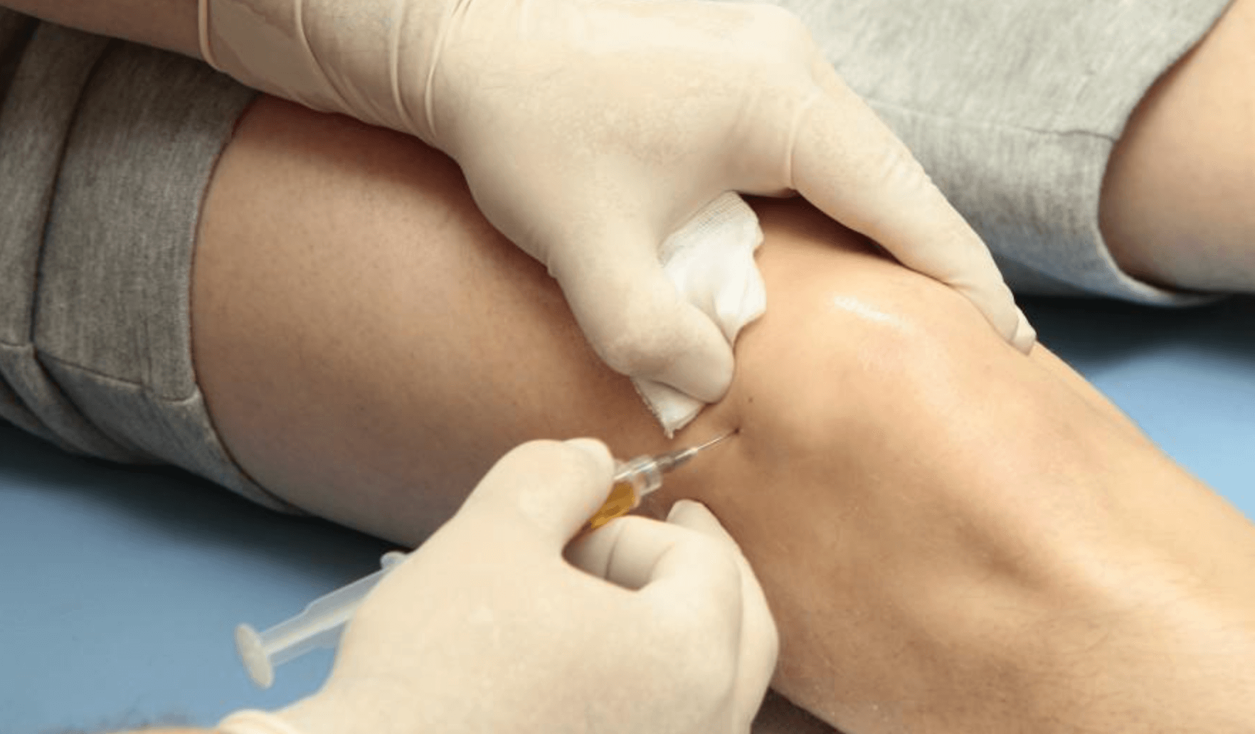 프롤로주사 비용